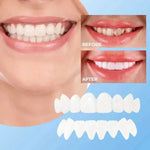 Lonryd SmileFlex Dental Veneers