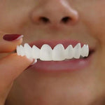 Lonryd SmileFlex Dental Veneers