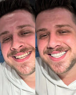 InstaSmile Pro