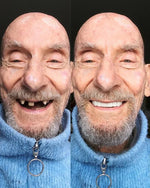 InstaSmile Pro