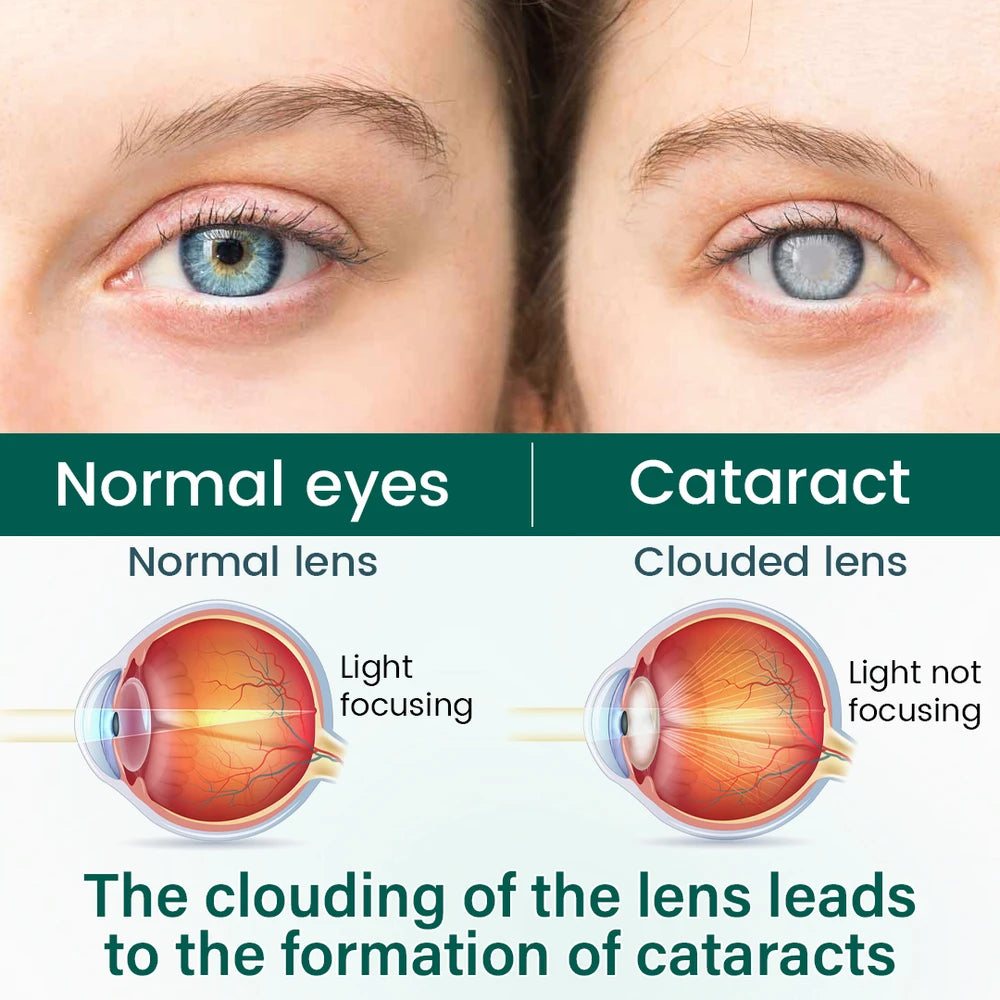 Ceoerty OptiClear Nano Eye Roller Serum