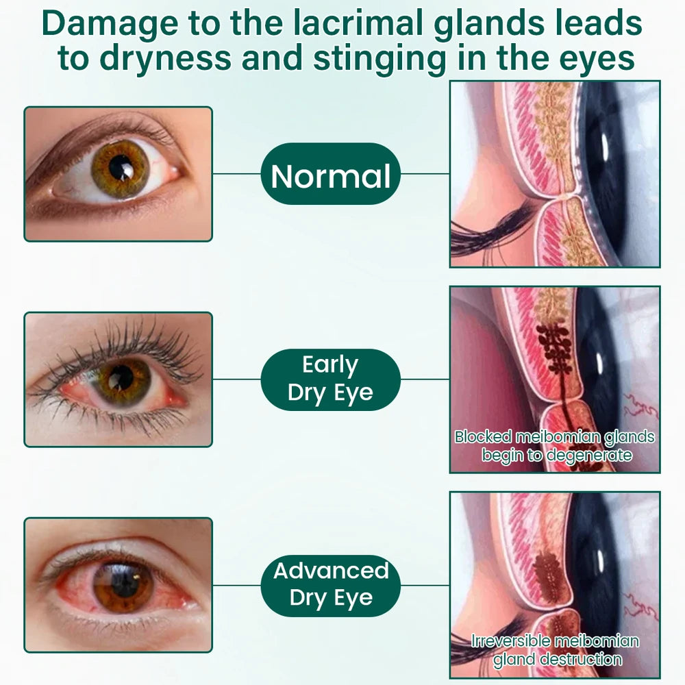 Ceoerty OptiClear Nano Eye Roller Serum