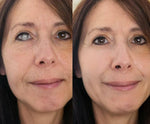 Ceoerty OptiClear Nano Eye Roller Serum
