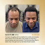Batana Oil Hair Regrowth Serum for Thinning Hair