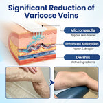 Deep Vein Repair Microneedle Patch