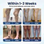 Deep Vein Repair Microneedle Patch
