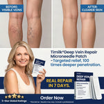 Deep Vein Repair Microneedle Patch