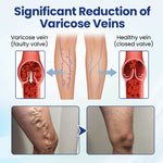 Deep Vein Repair Microneedle Patch