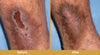 GlucaVeil 24H Foot Spray
