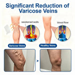 Veltriva Microneedle Leg Patches