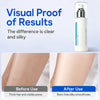 Ice Glow Hair Removal Cream