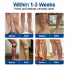 Veltriva Microneedle Leg Patches
