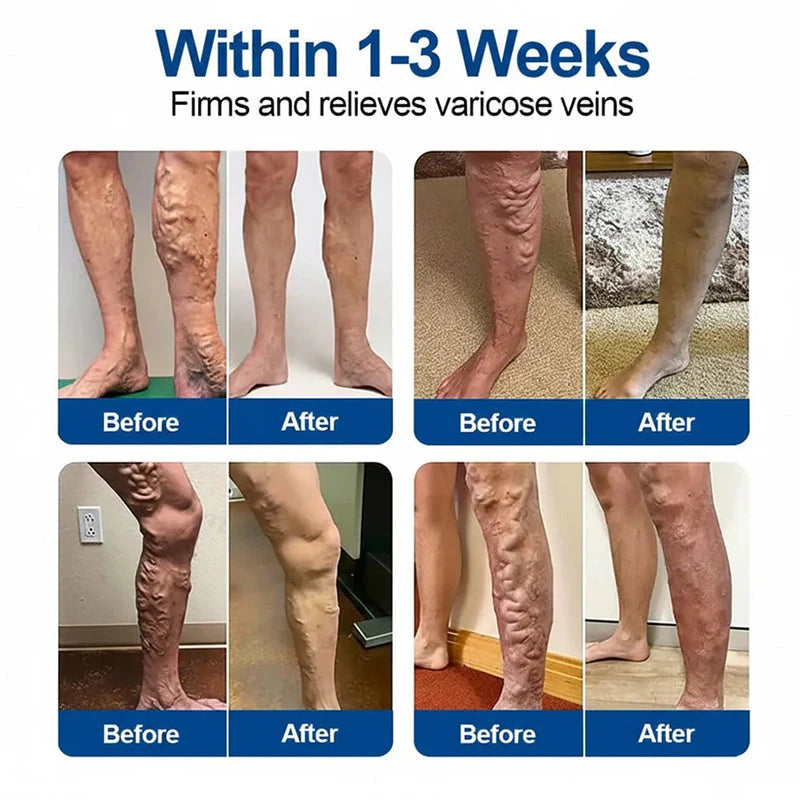 Veltriva Microneedle Leg Patches