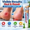 Diabetic Foot Cream for Cracked Heels