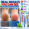 Diabetic Foot Cream for Cracked Heels