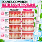 Sensitive Teeth Repair Gel