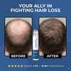 Aparthé Folivane Scalp Roll-On