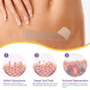 ScarLuxe Advanced Nano Microneedle Scar Care Tape