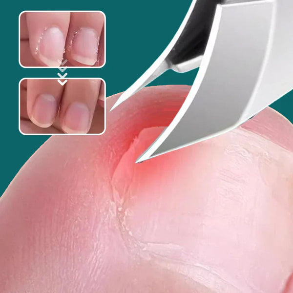 Anti-Splash 25° Slant Edge Nail Clipper 3-Piece Set