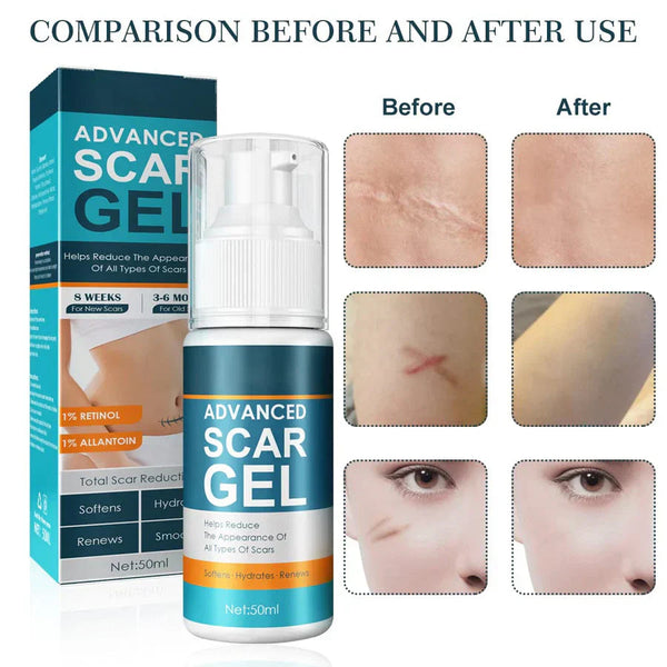 Bioskin Advanced Scar Removal Gel|Scars fade beautifully