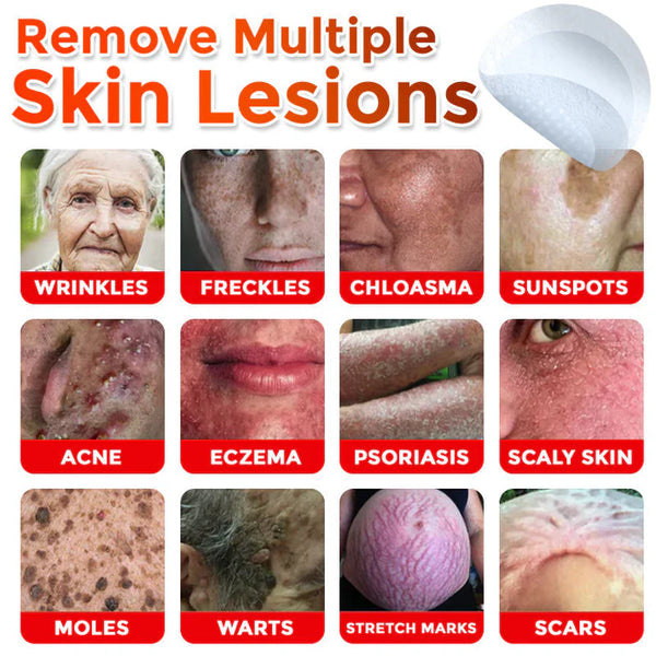 Botanic Skin Tag Removal Patch