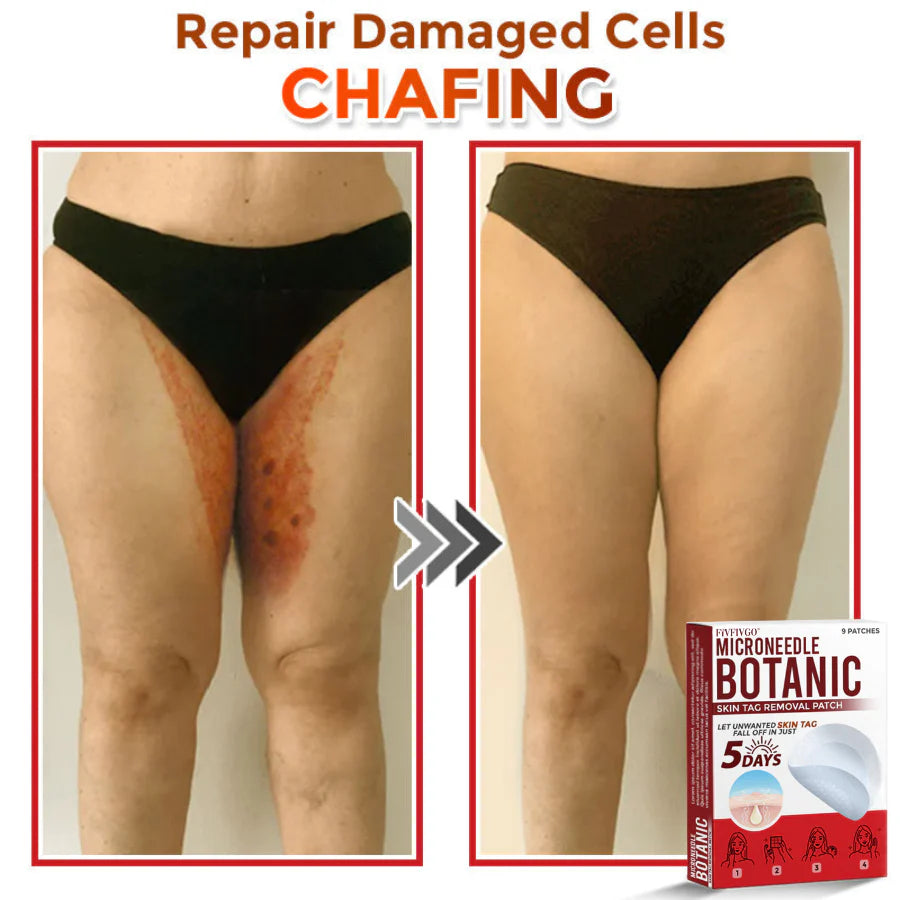 Botanic Skin Tag Removal Patch